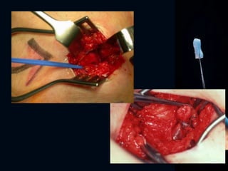 Images: Mr Neeraj Bhas
 