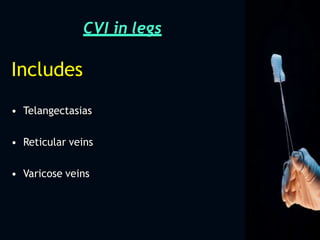 CVI in legs
Includes
• Telangectasias
• Reticular veins
• Varicose veins
 