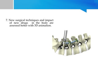 7. New surgical techniques and impact
of new drugs in the body are
assessed better with 3D animation.

 