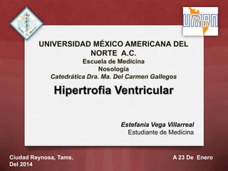 Hipertrofia Ventricular
Estefanía Vega Villarreal
Estudiante de Medicina
Ciudad Reynosa, Tams. A 23 De Enero
Del 2014
 