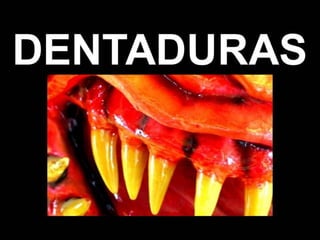 Vegetarianismo y Dentaduras
