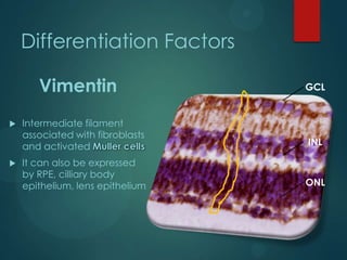 Differentiation Factors
Vimentin




GCL

Intermediate filament
associated with fibroblasts
and activated Muller cells

INL

It can also be expressed
by RPE, cilliary body
epithelium, lens epithelium

ONL

 
