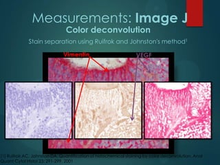 Measurements: Image J
Color deconvolution

Stain separation using Ruifrok and Johnston's method1
Vimentin

VEGF

[1] Ruifrok AC, Johnston DA. Quantification of histochemical staining by color deconvolution. Anal
Quant Cytol Histol 23: 291-299, 2001

 