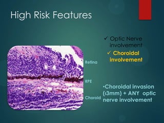 High Risk Features

Retina

RPE

Choroid

 Optic Nerve
involvement
 Choroidal
involvement

•Choroidal invasion
(‹3mm) + ANY optic
nerve involvement

 
