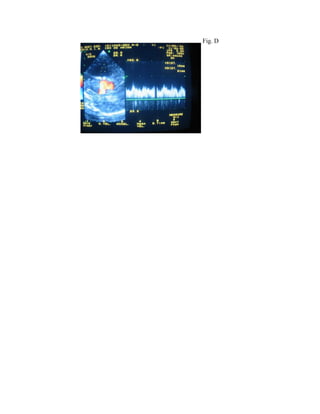 Fig. D 
