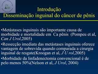 Introdução Disseminação inguinal do câncer de pênis Metástases inguinais são importante causa de morbidade e mortalidade em  Ca pênis  (Pompeu et al,  Can J Urol ,2005) Ressecção imediata das metástases inguinais oferece vantagem de sobrevida quando comparada a cirurgia inguinal de resgate(Kroogan et al,  J U rol ,2005) Morbidade da linfadenectomia convencional é de pelo menos 50%(Nelson et al,  J Urol , 2004) 