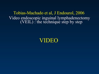 VIDEO  Tobias-Machado et al, J Endourol, 2006   Video endoscopic inguinal lymphadenectomy (VEIL) : the technique step by step 