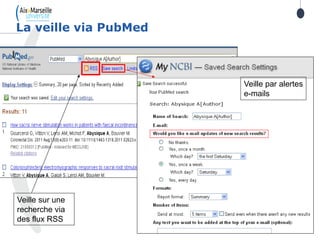 La veille via PubMed
Veille sur une
recherche via
des flux RSS
Veille par alertes
e-mails
 