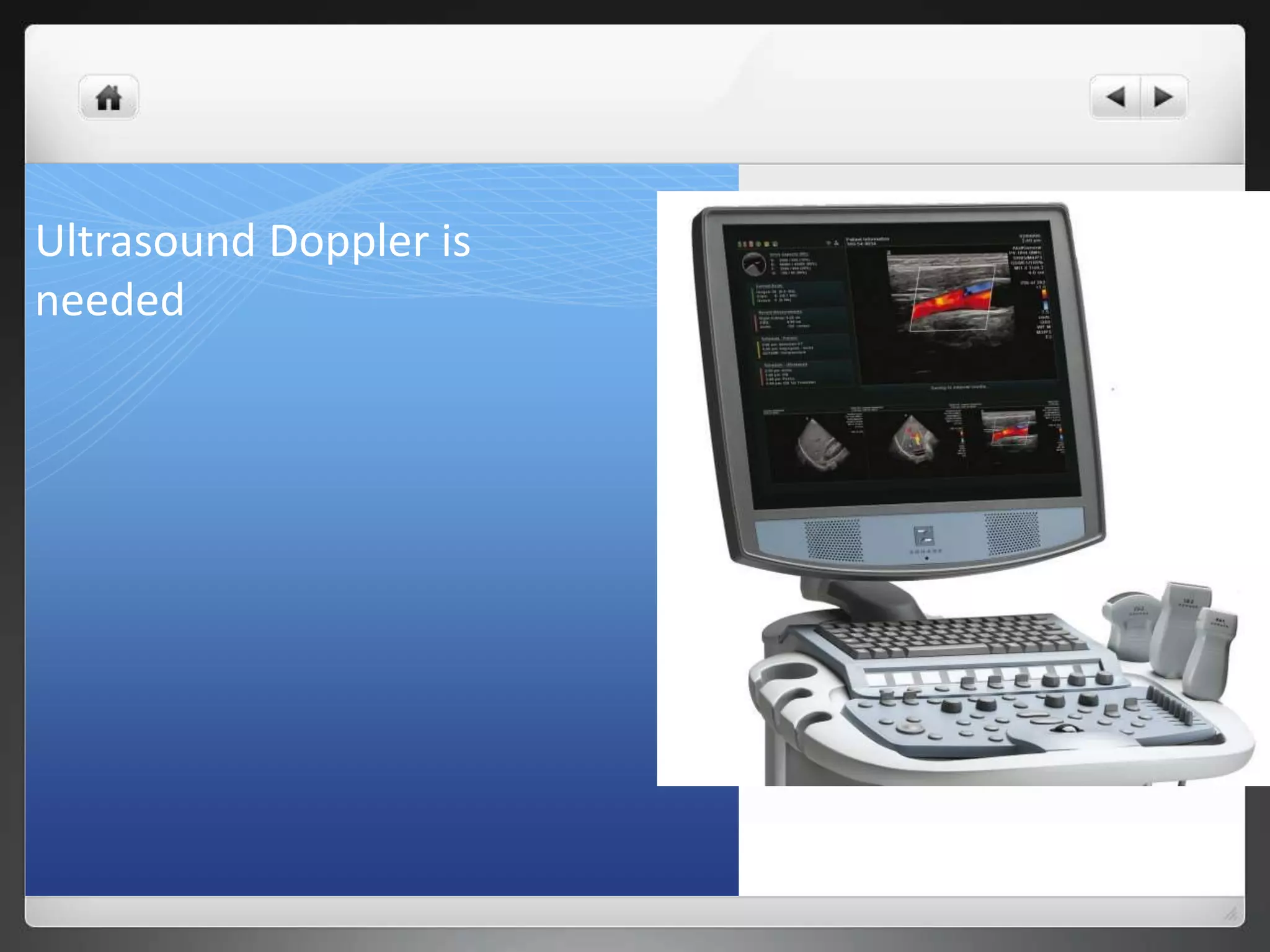 Ultrasound Doppler is
needed