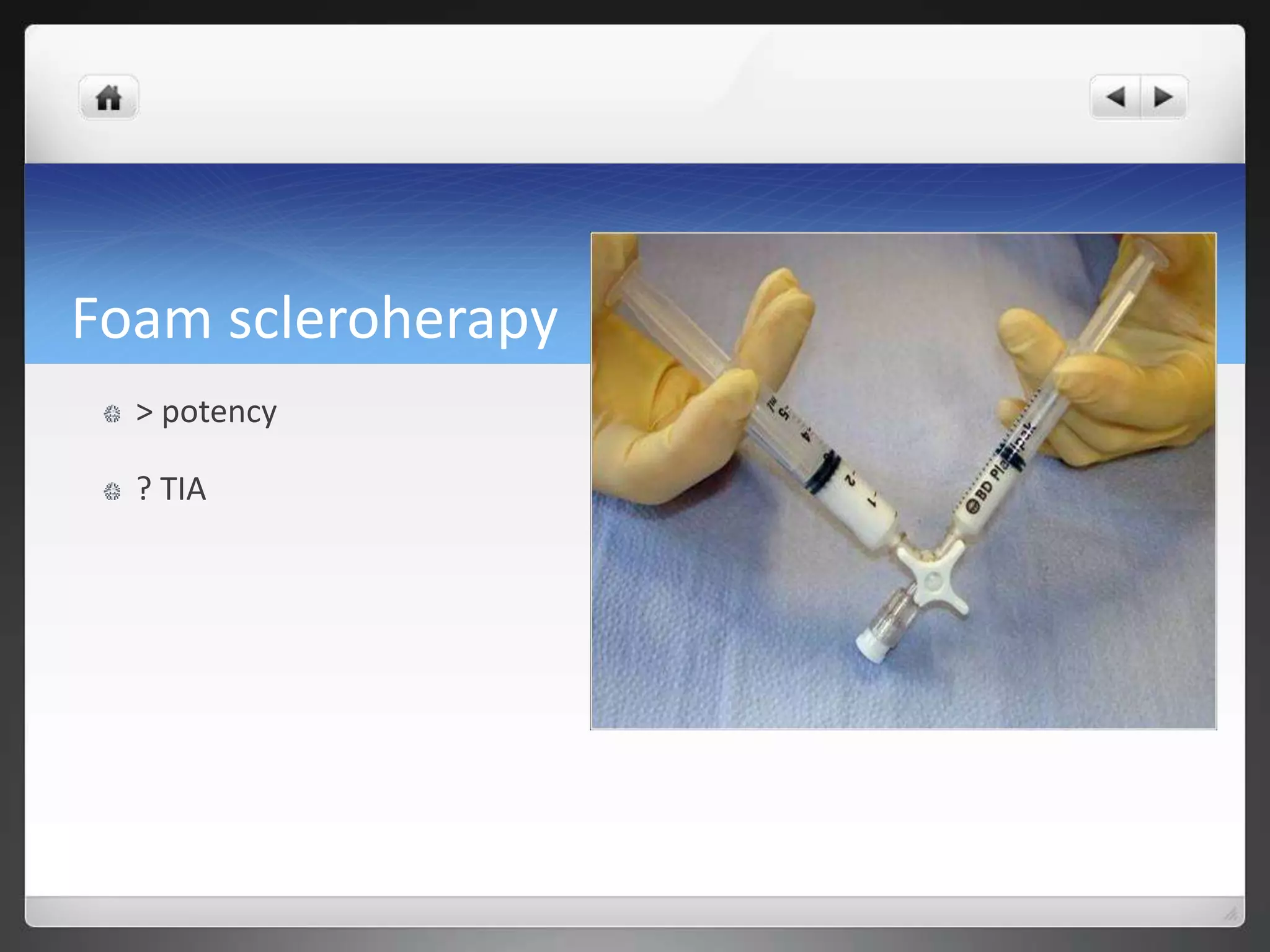 Foam scleroherapy
> potency
? TIA