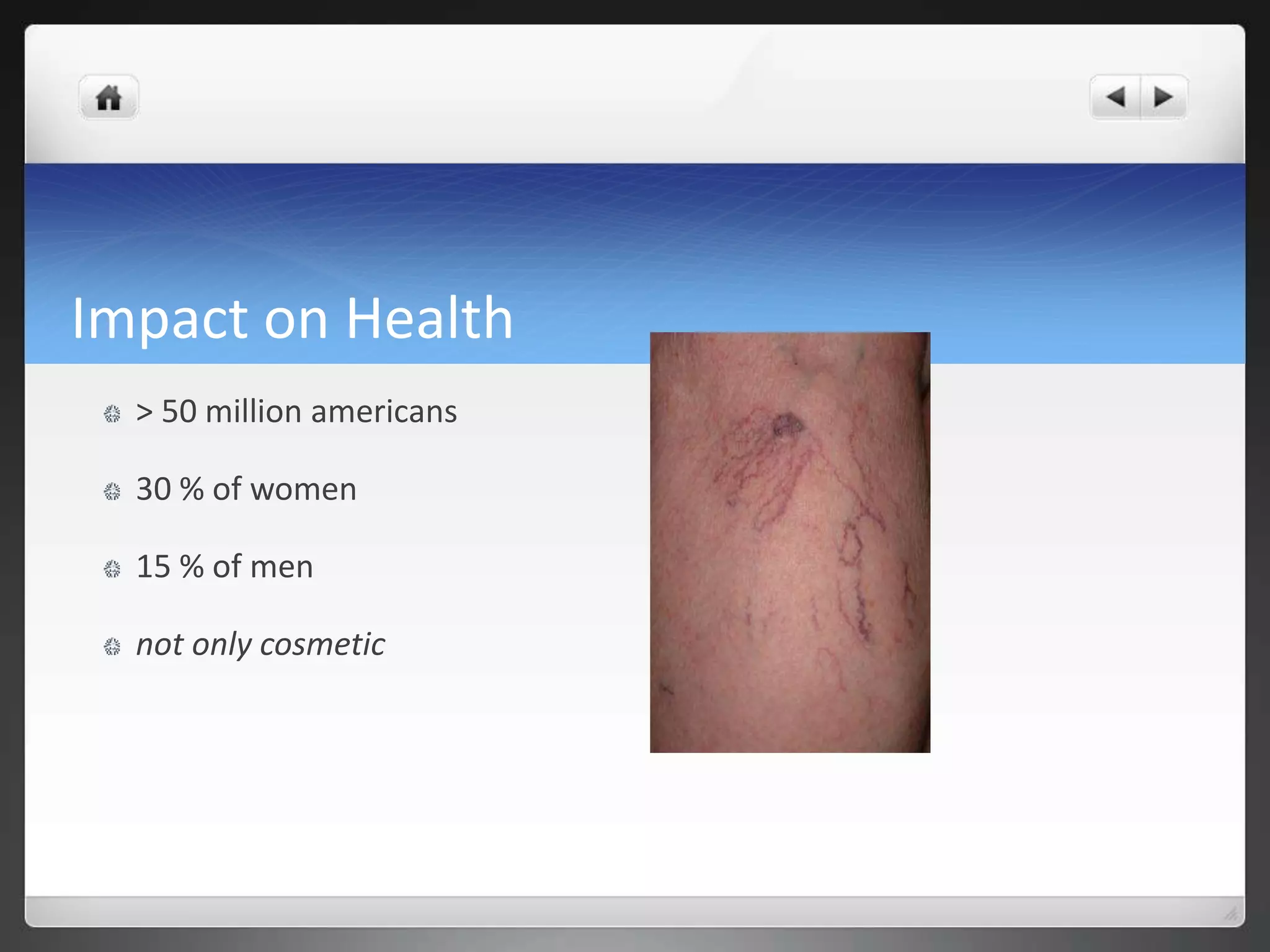 Impact on Health
> 50 million americans
30 % of women
15 % of men
not only cosmetic