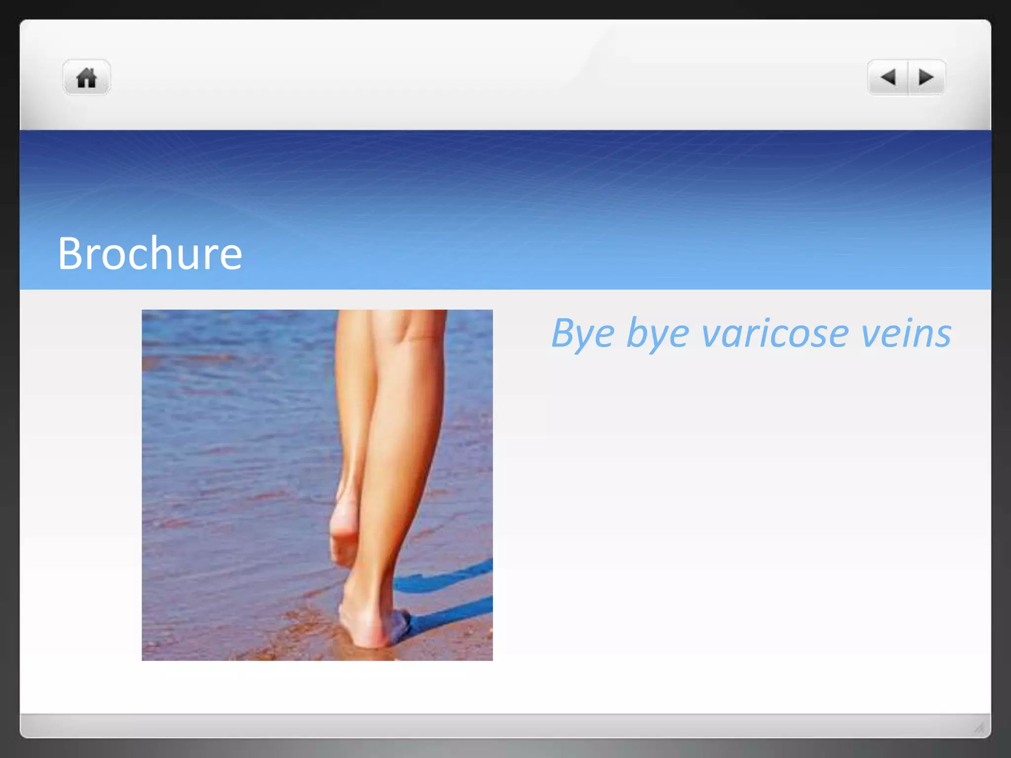 Brochure
Bye bye varicose veins