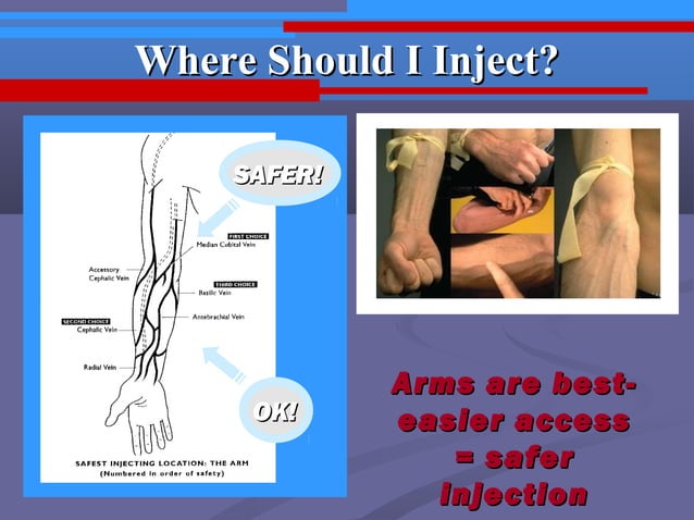 Vein care & safer injection tips | PPT