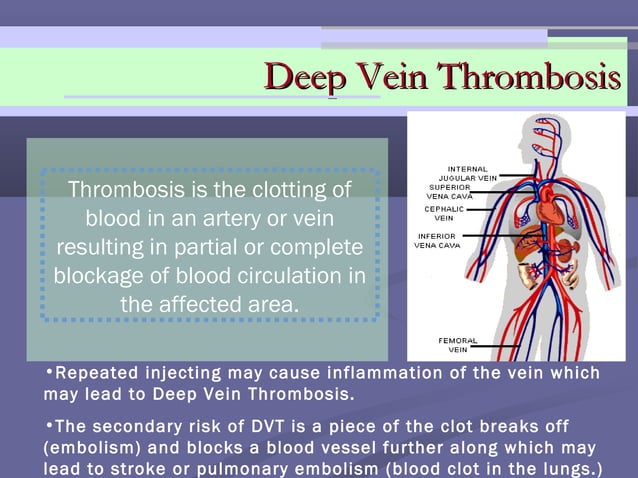 Vein care & safer injection tips | PPT