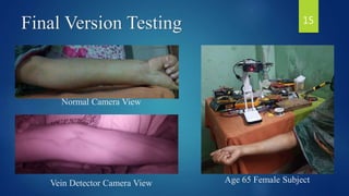 Final Version Testing
Normal Camera View
Vein Detector Camera View Age 65 Female Subject
15
 