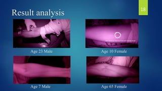 Age 23 Male
Result analysis
Age 7 Male
Age 10 Female
Age 65 Female
18
 