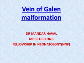 Vein of Galen 
malformation 
DR MANDAR HAVAL 
MBBS DCH DNB 
FELLOWSHIP IN NEONATOLOGY(NNF) 
 
