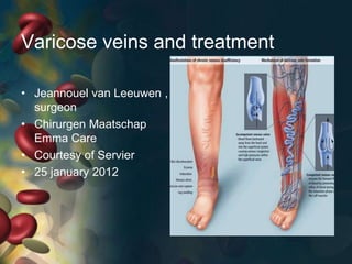 Varicose veins and treatment

• Jeannouel van Leeuwen ,
  surgeon
• Chirurgen Maatschap
  Emma Care
• Courtesy of Servier
• 25 january 2012
 