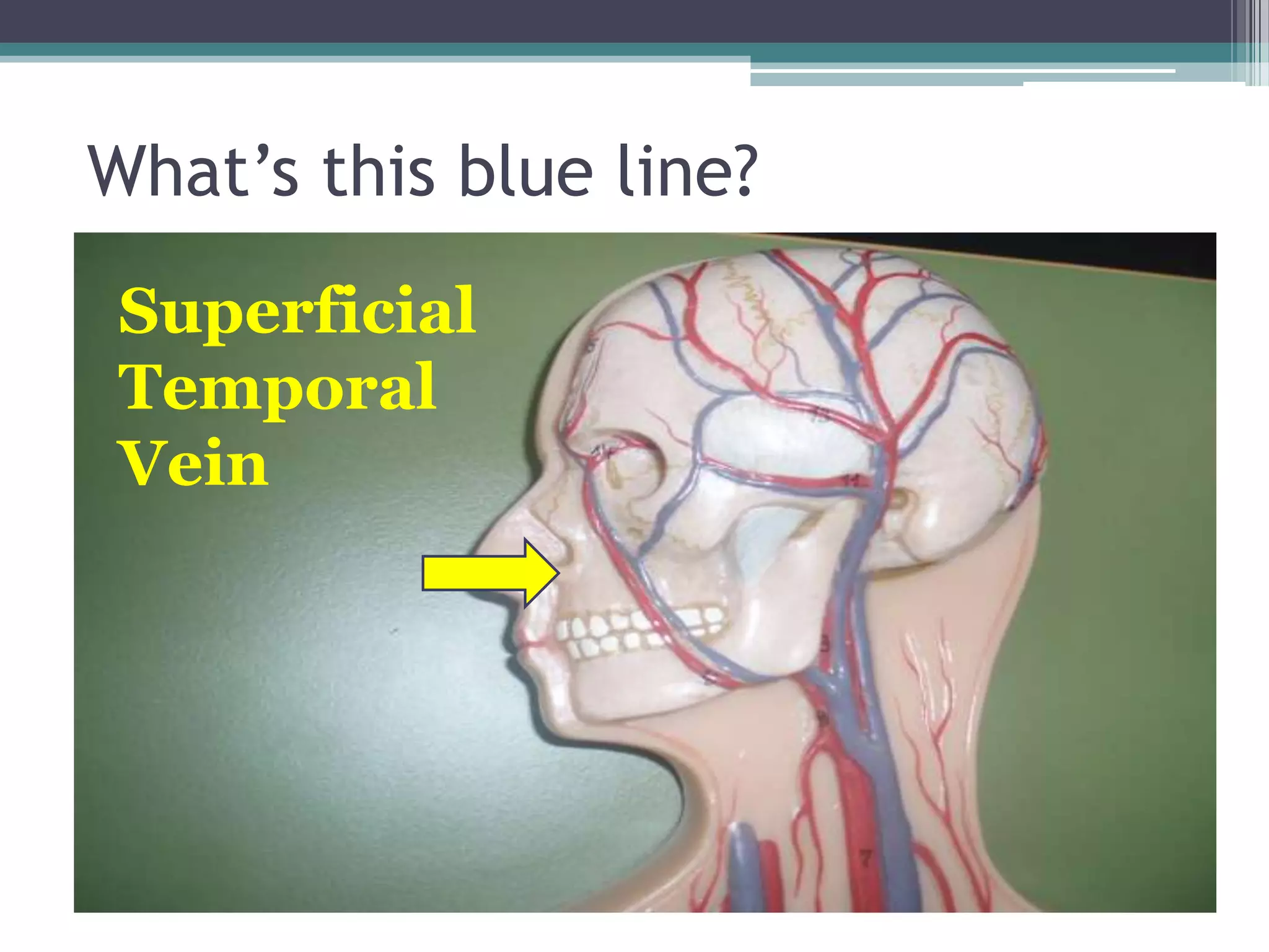 What’s this blue line?Superficial Temporal Vein
