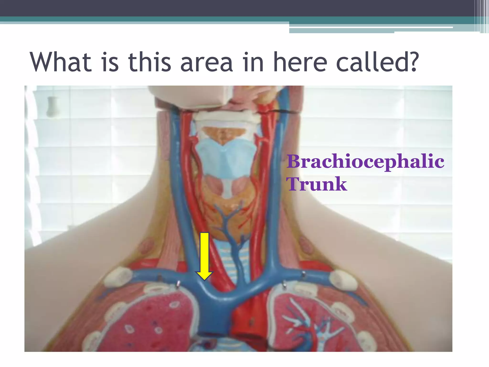 What is this area in here called?BrachiocephalicTrunk