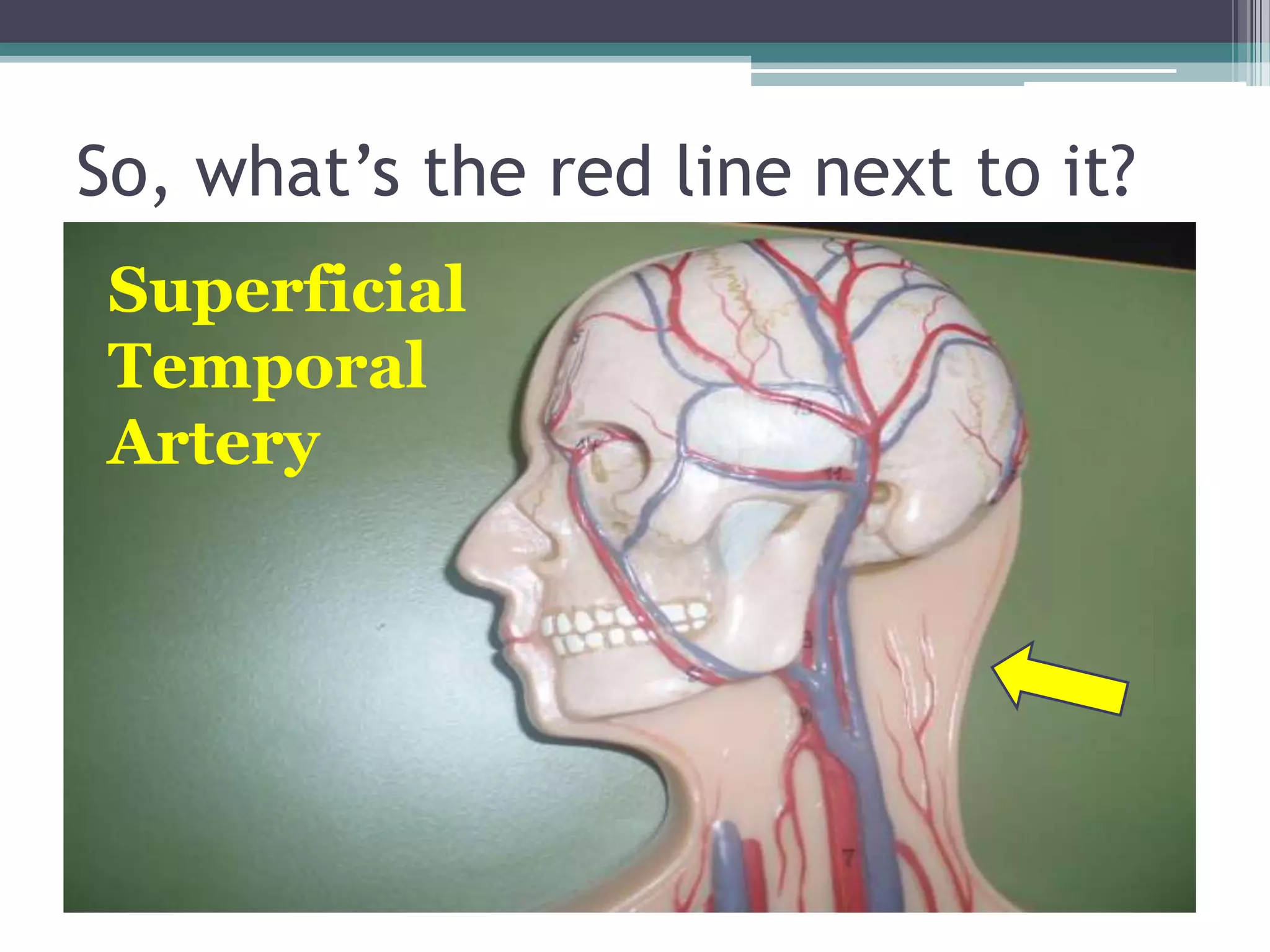 So, what’s the red line next to it?Superficial Temporal Artery