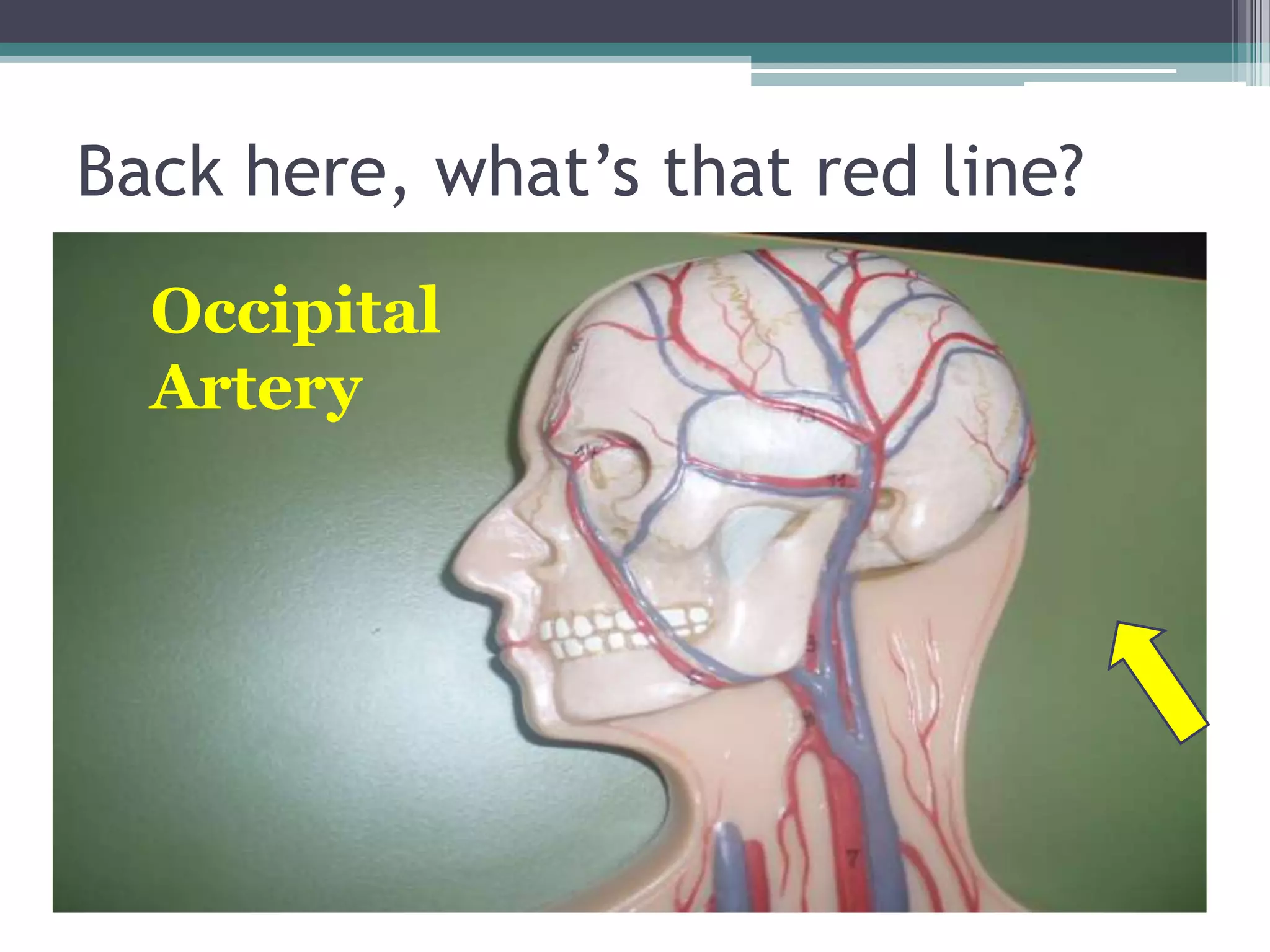 Back here, what’s that red line?Occipital Artery