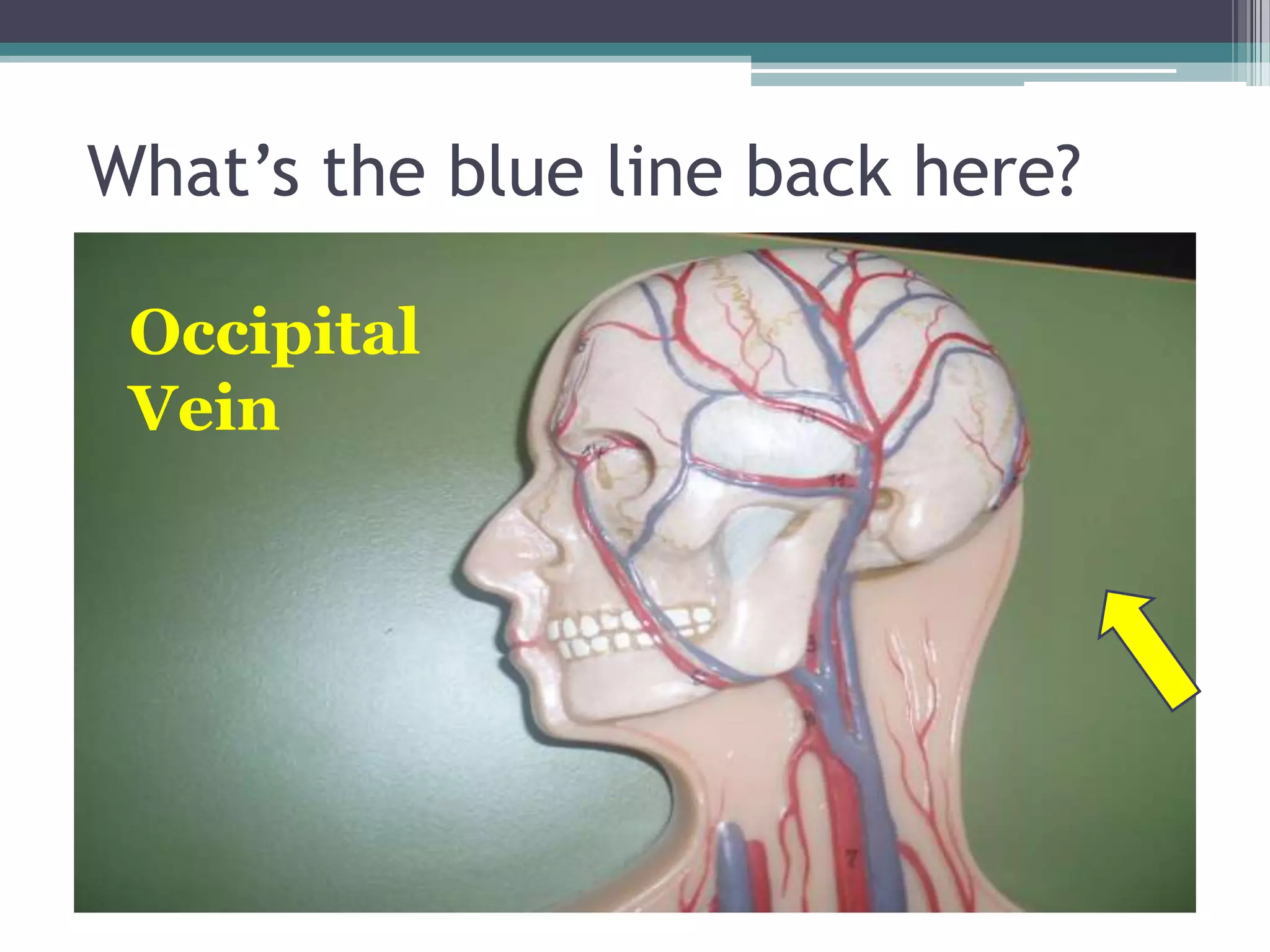 What’s the blue line back here?Occipital Vein