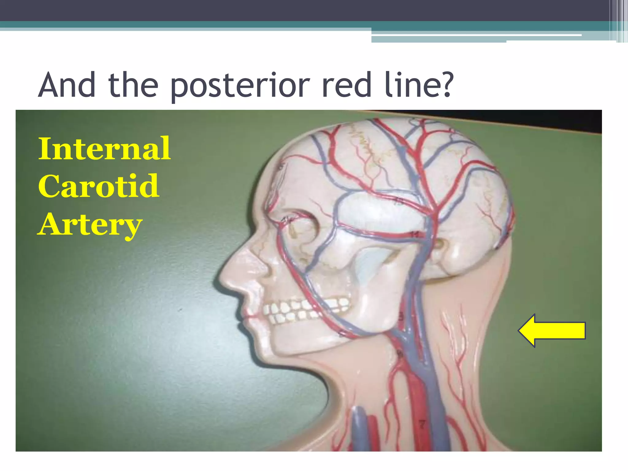 And the posterior red line?Internal Carotid Artery