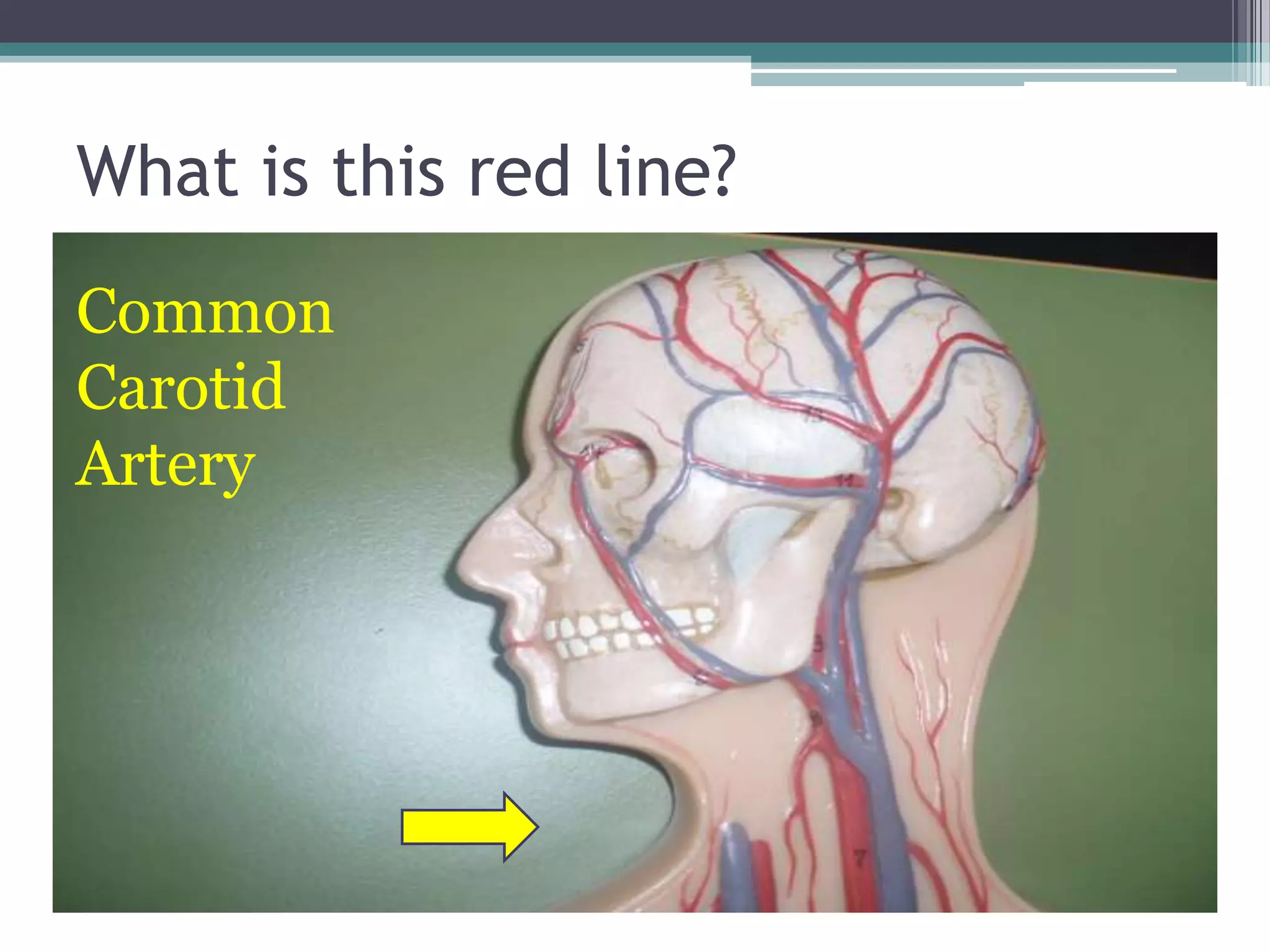 What is this red line?Common Carotid Artery