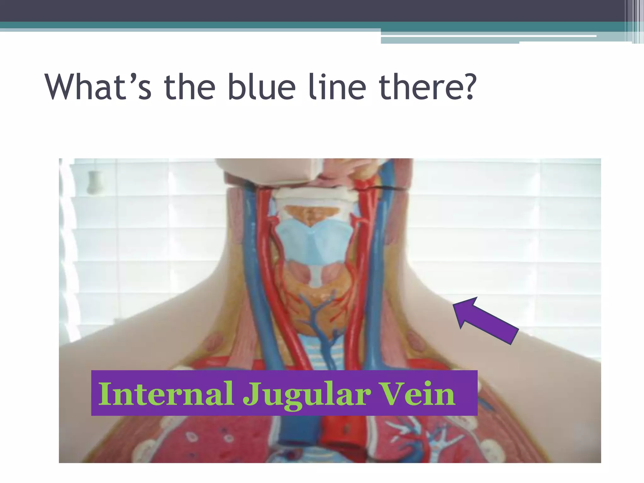 What’s the blue line there?Internal Jugular Vein