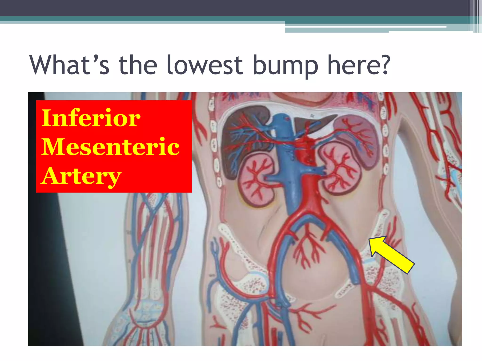 What’s the lowest bump here?Inferior Mesenteric Artery