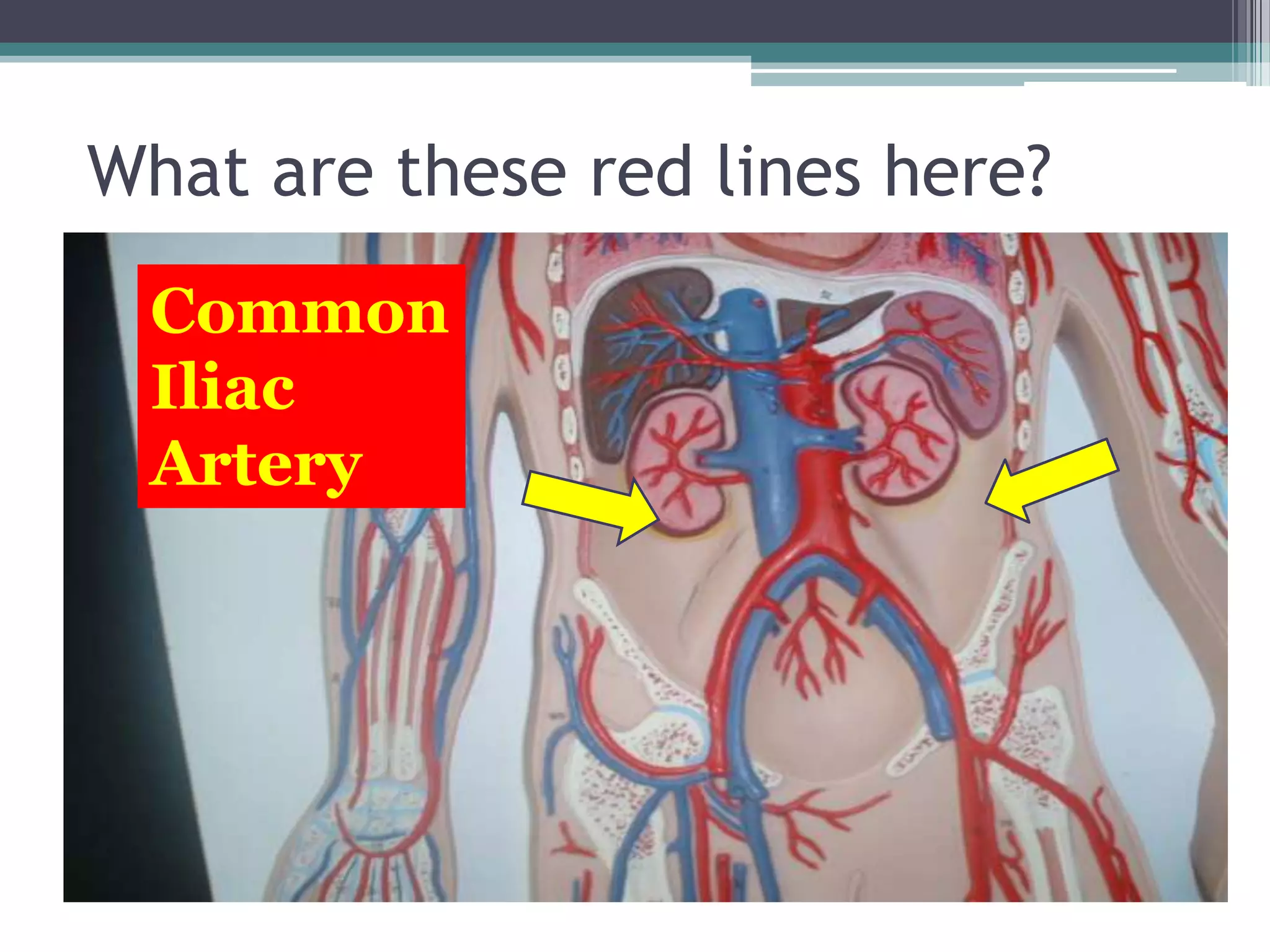 What are these red lines here?CommonIliac Artery