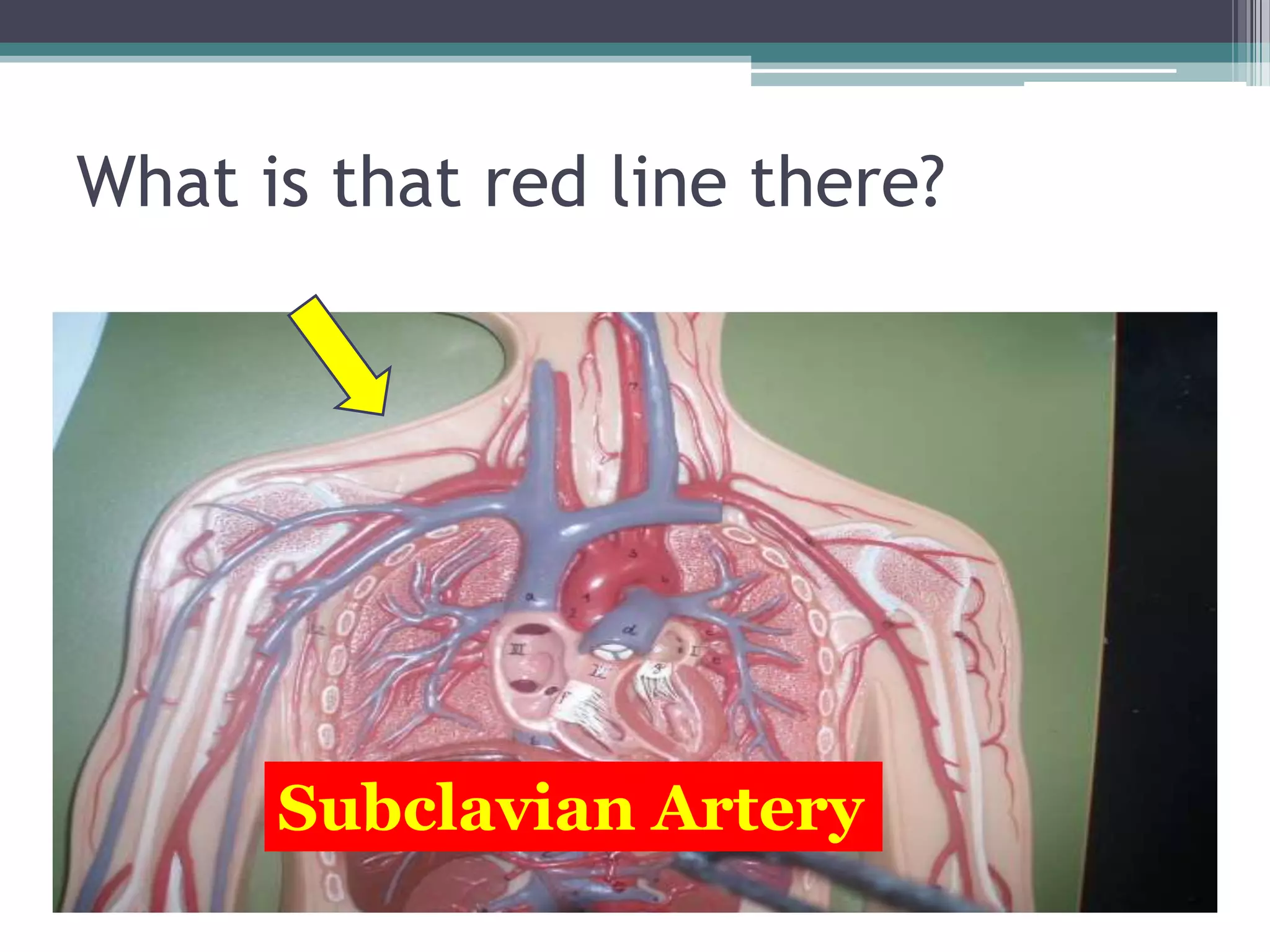 What is that red line there?Subclavian Artery