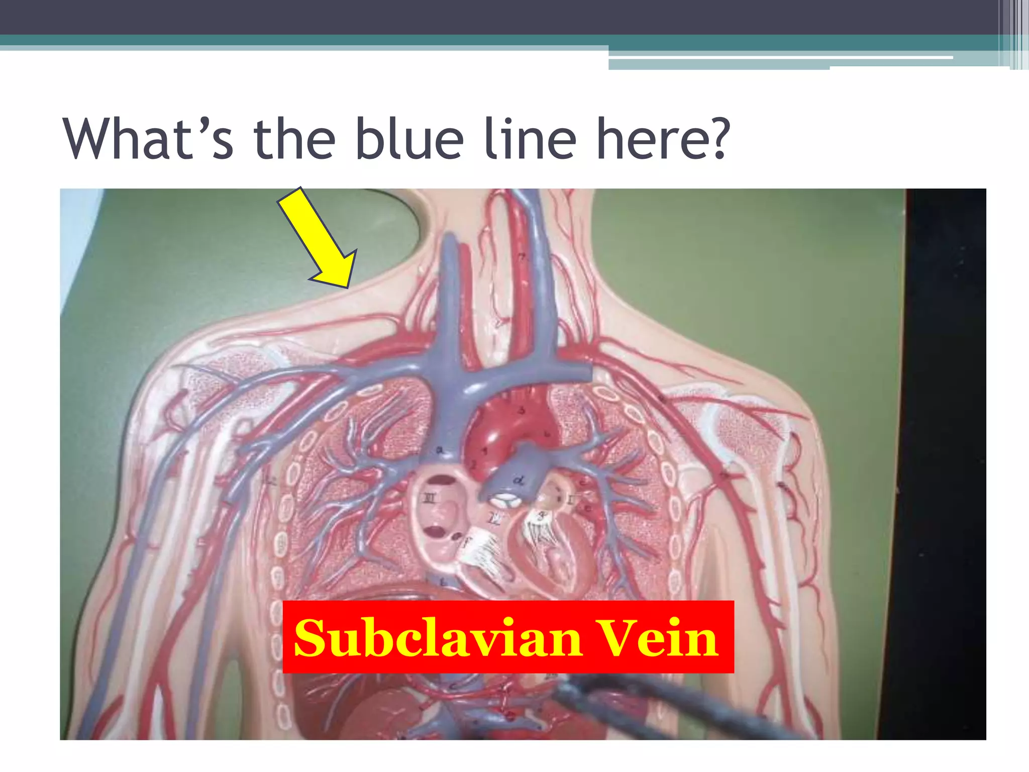 What’s the blue line here?Subclavian Vein