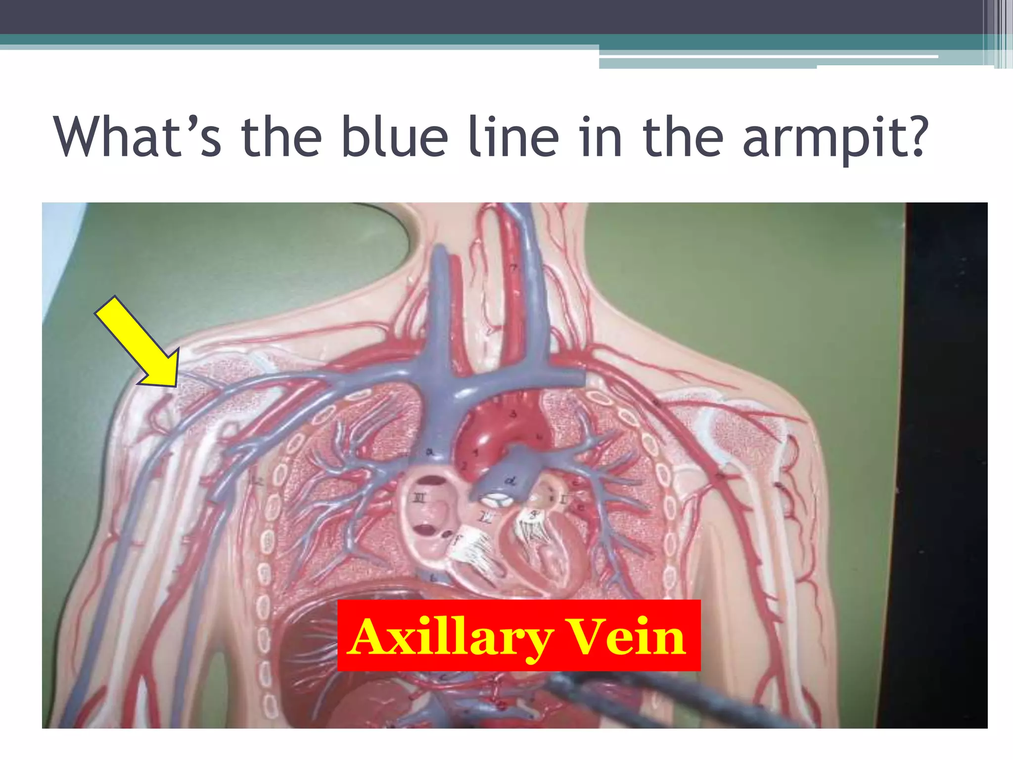 What’s the blue line in the armpit?Axillary Vein