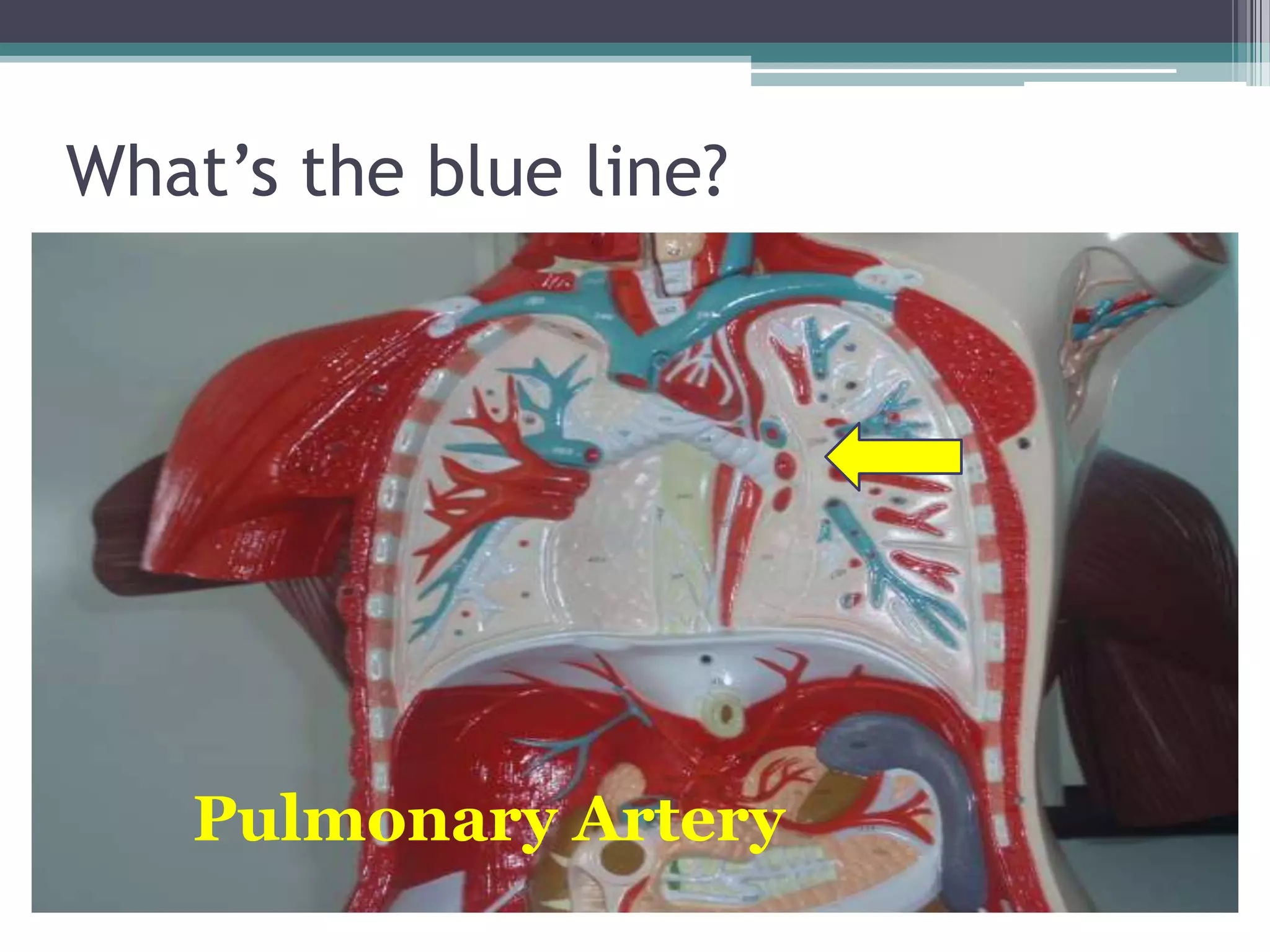 What’s the blue line?Pulmonary Artery