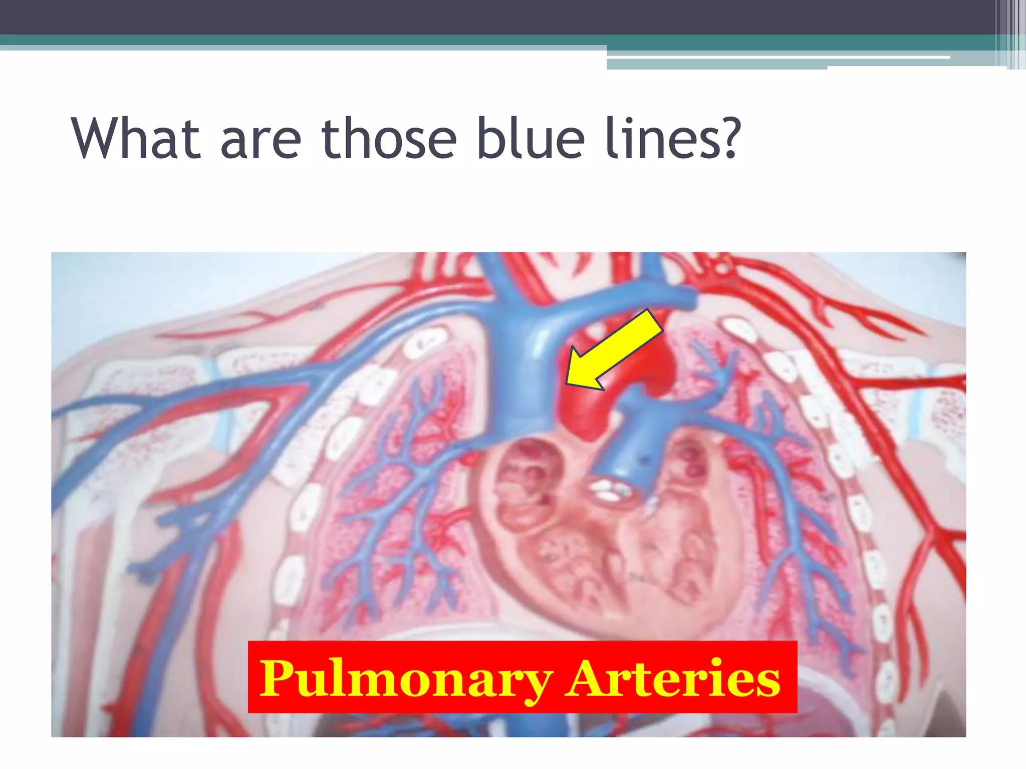 What are those blue lines?Pulmonary Arteries