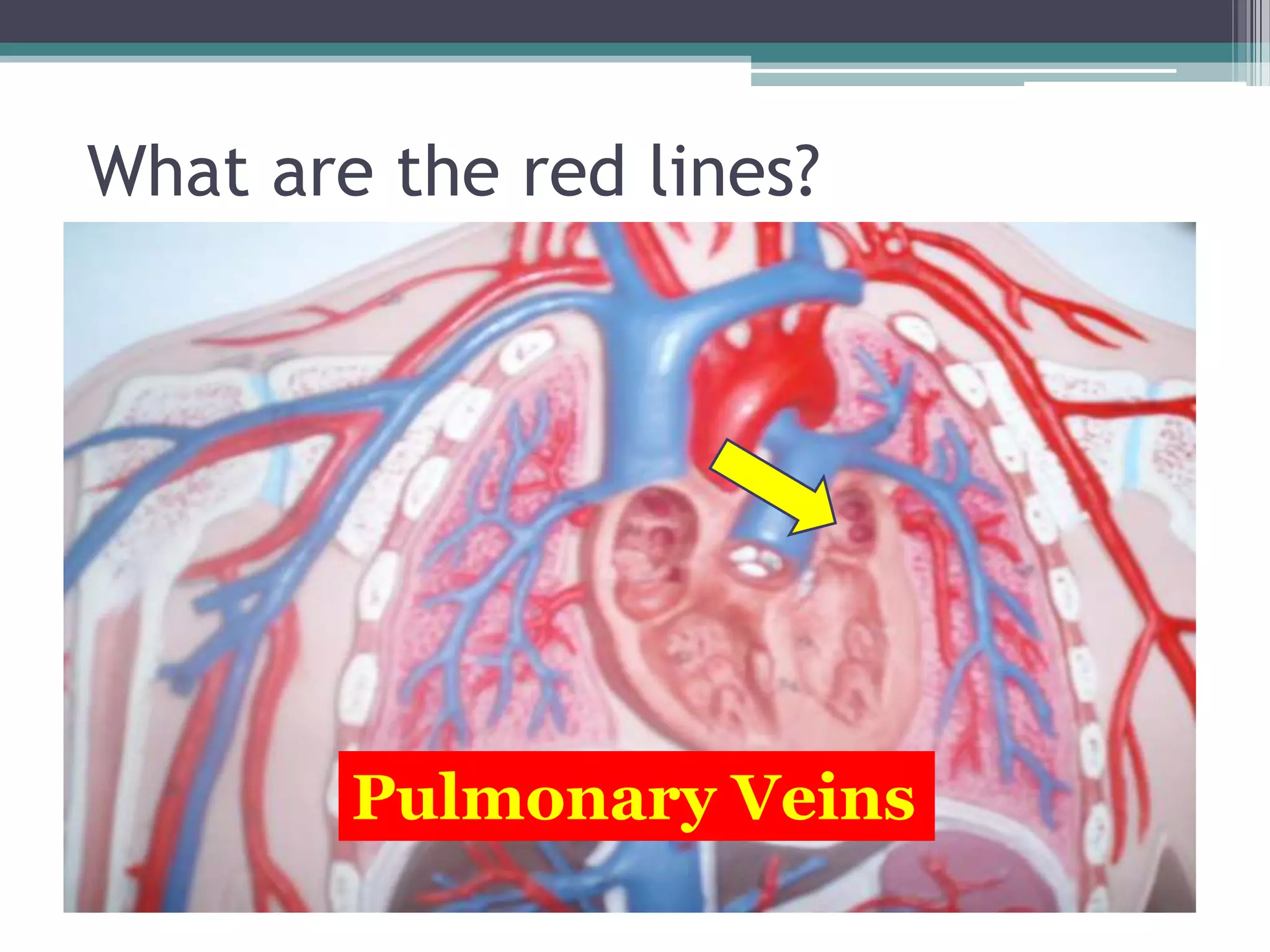 What are the red lines? Pulmonary Veins