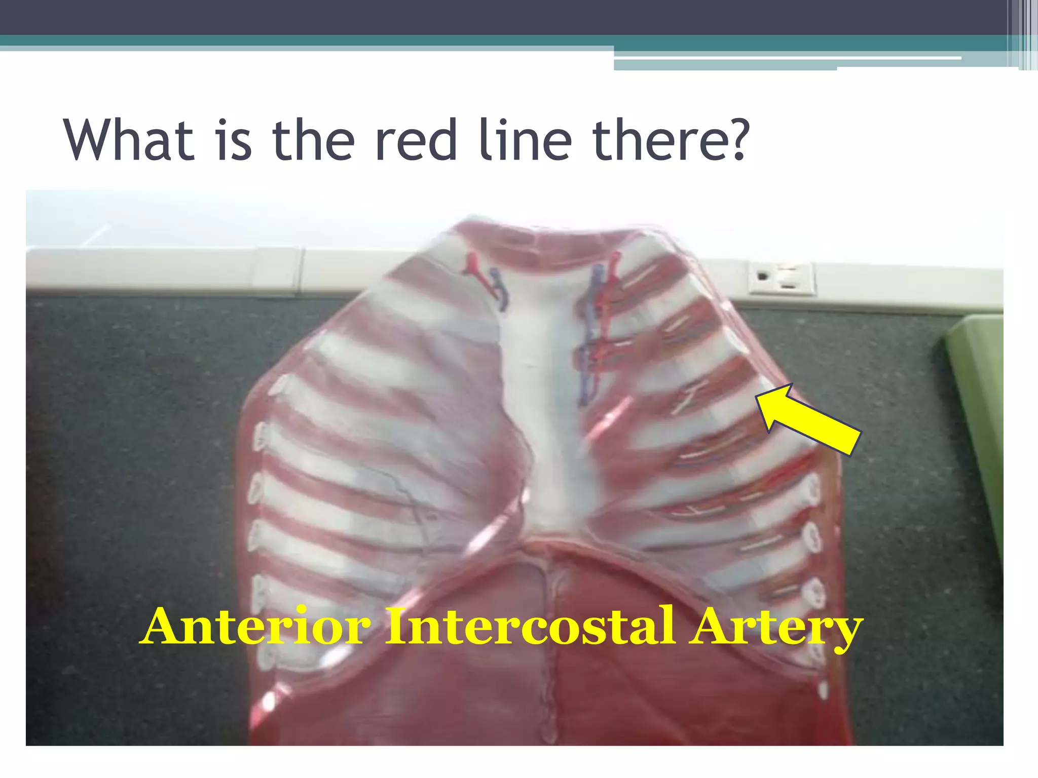 What is the red line there?Anterior Intercostal Artery