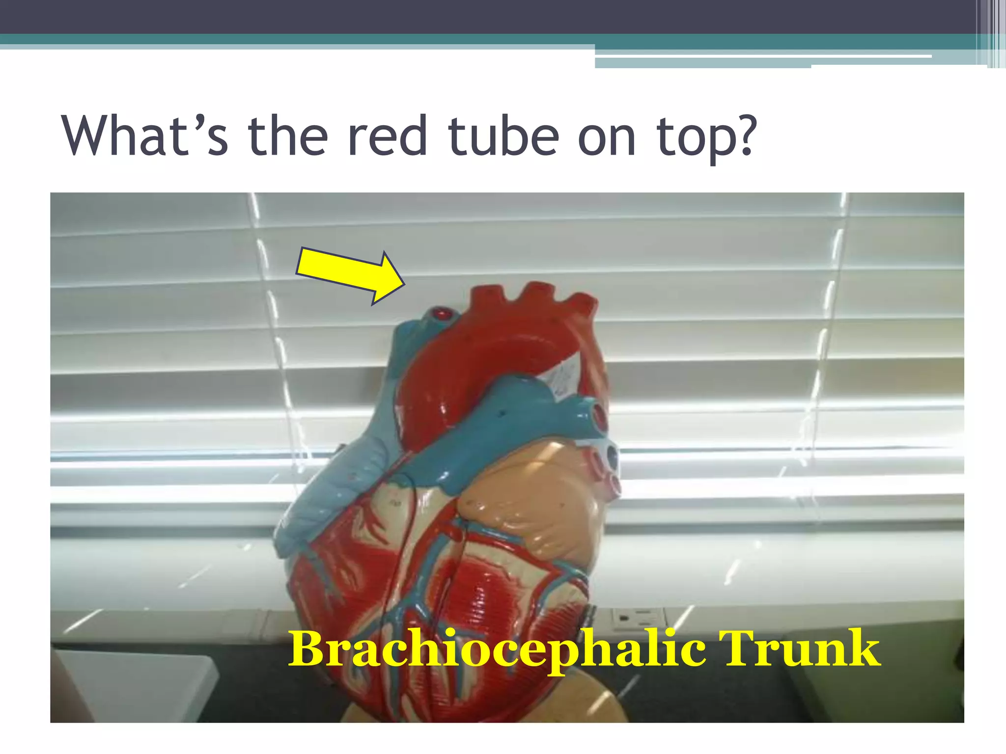 What’s the red tube on top?Brachiocephalic Trunk