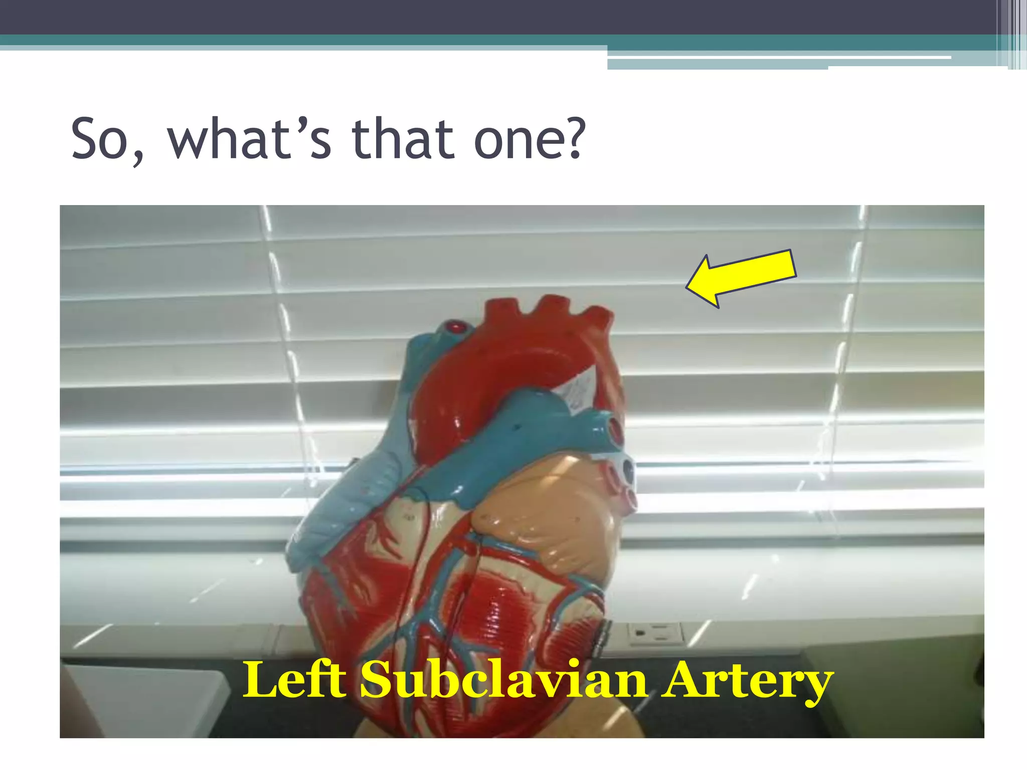 So, what’s that one?Left Subclavian Artery
