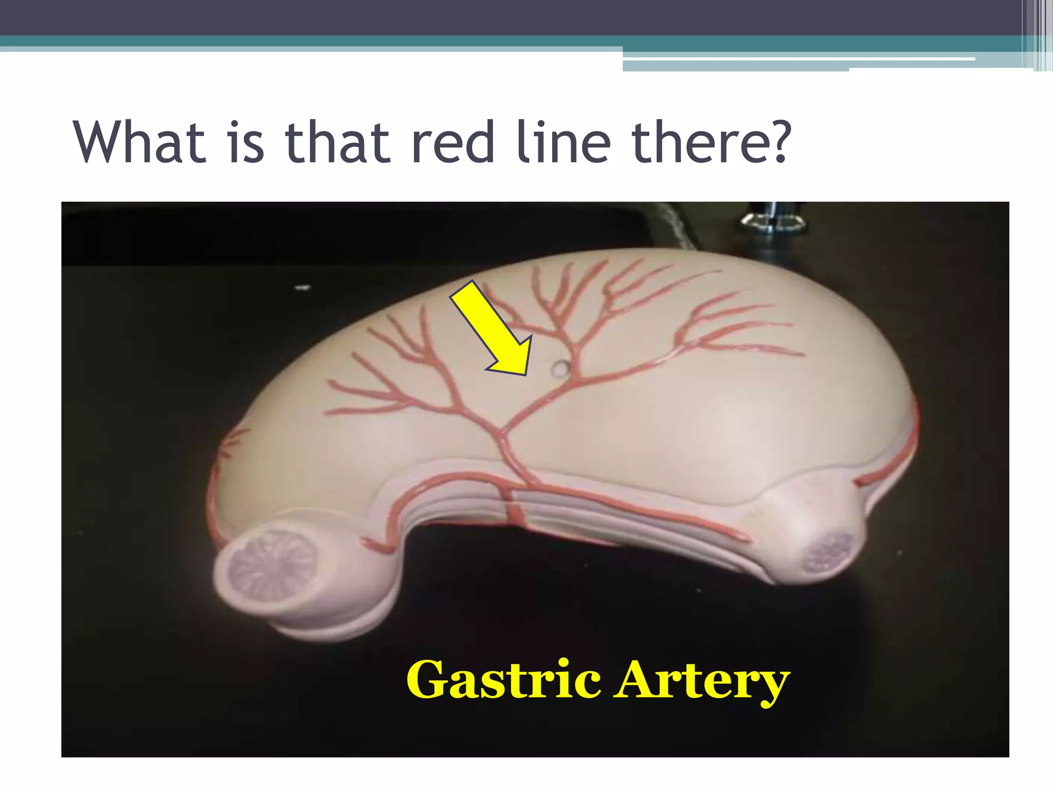 What is that red line there?Gastric Artery