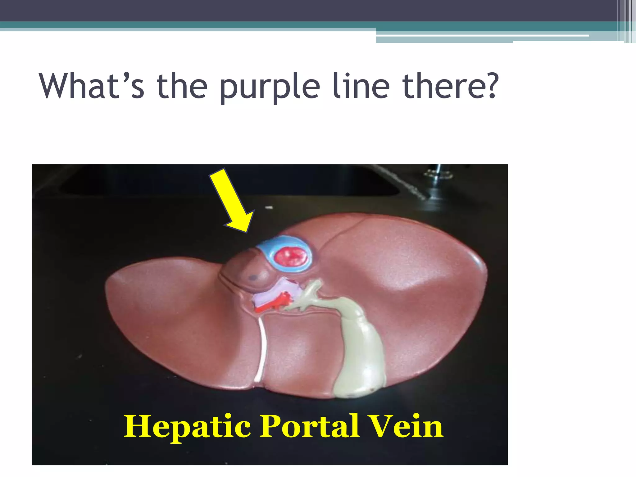 What’s the purple line there?Hepatic Portal Vein