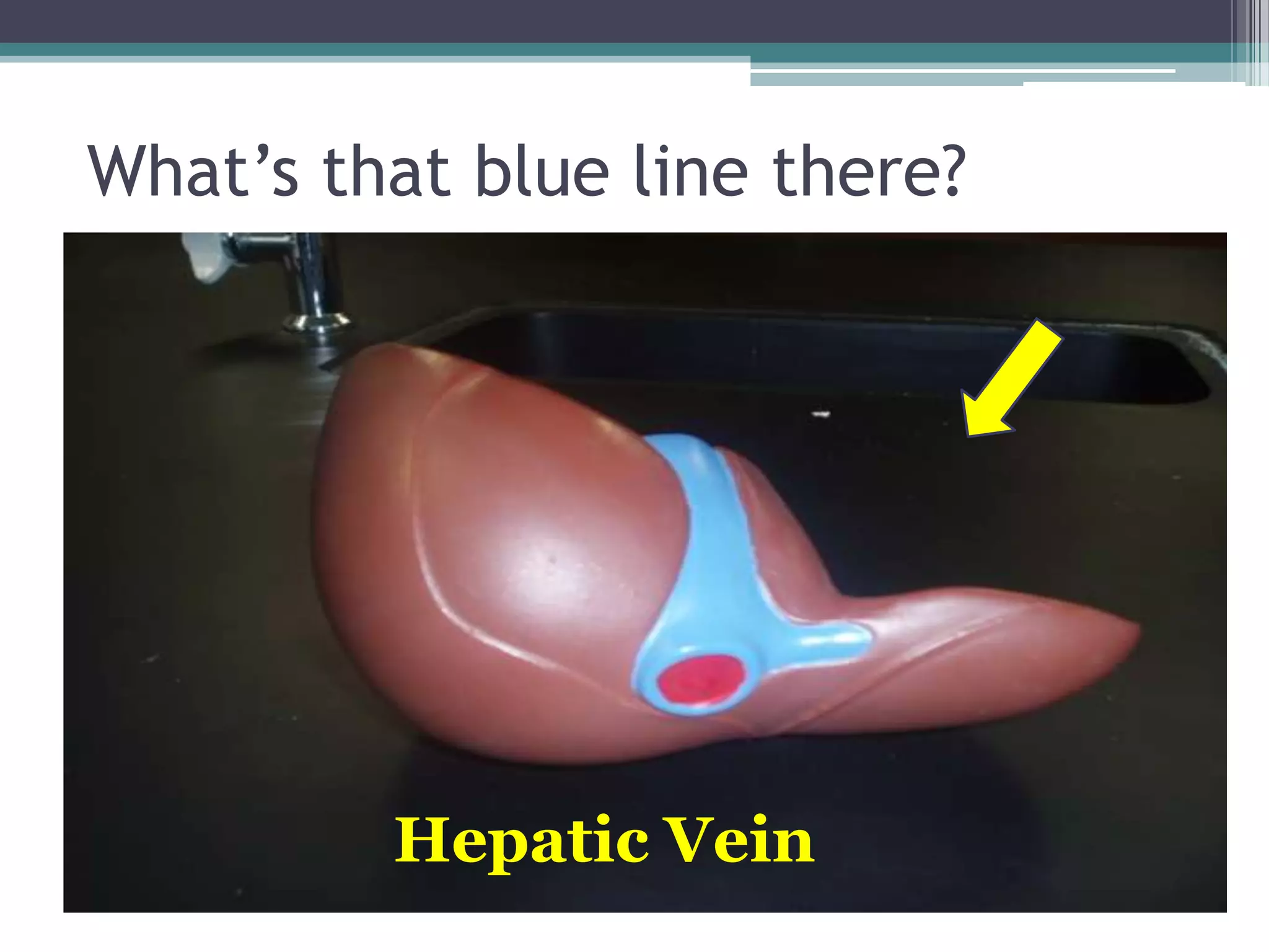 What’s that blue line there?Hepatic Vein