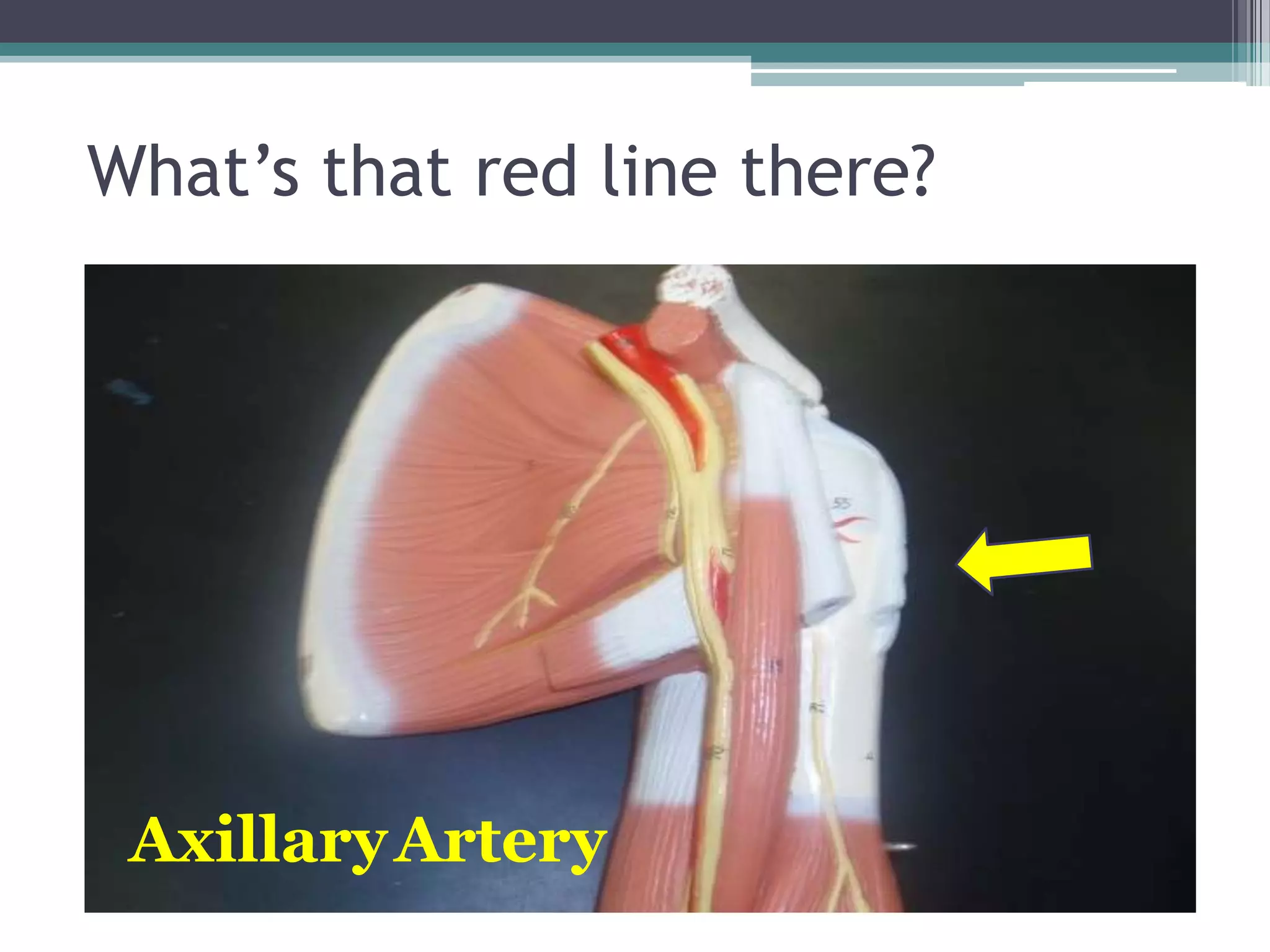 What’s that red line there?AxillaryArtery