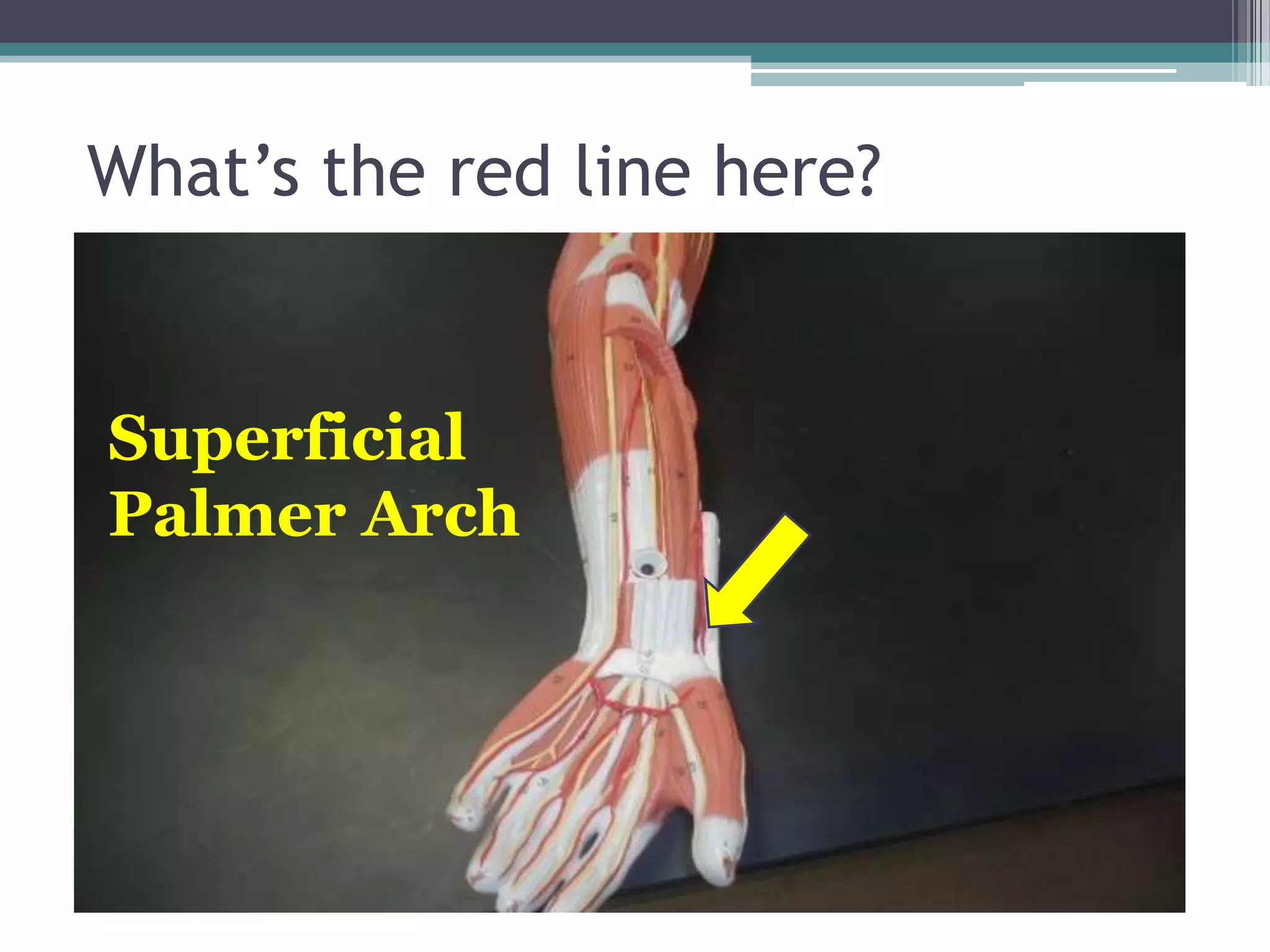 What’s the red line here?Superficial Palmer Arch