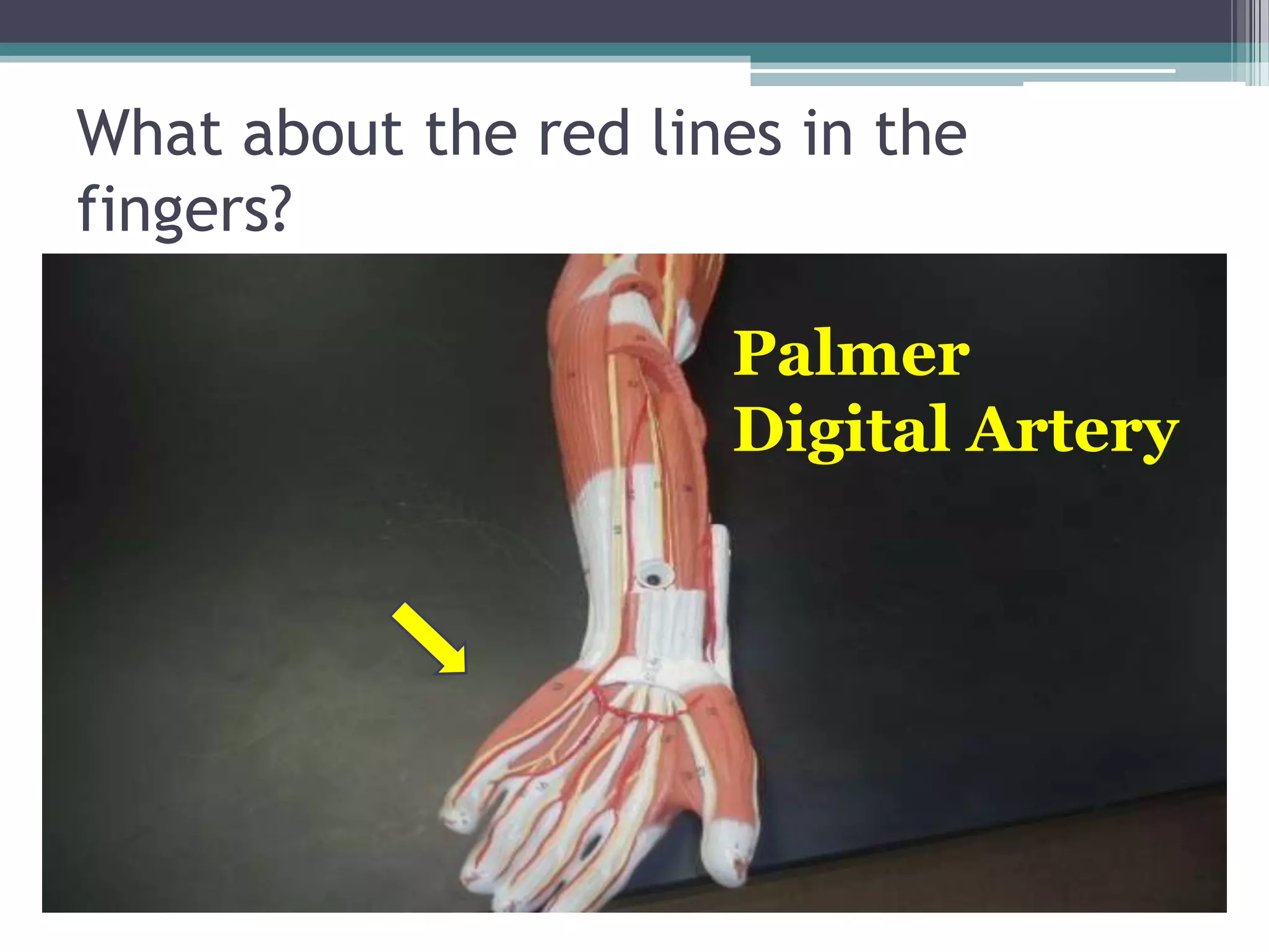 What about the red lines in the fingers?PalmerDigital Artery