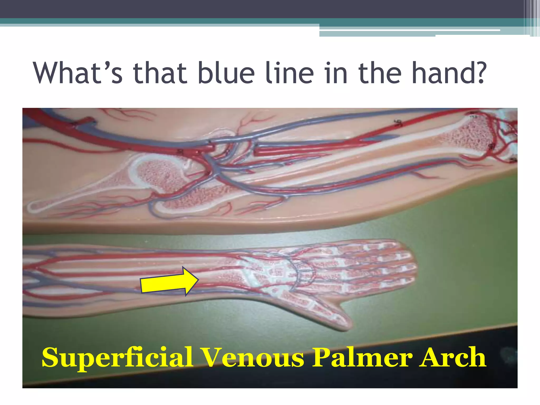 What’s that blue line in the hand?Superficial Venous Palmer Arch