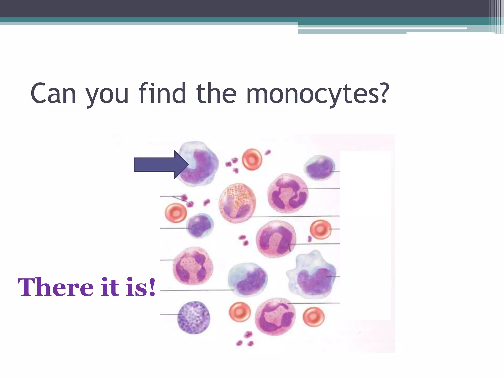 Can you find the monocytes?There it is!