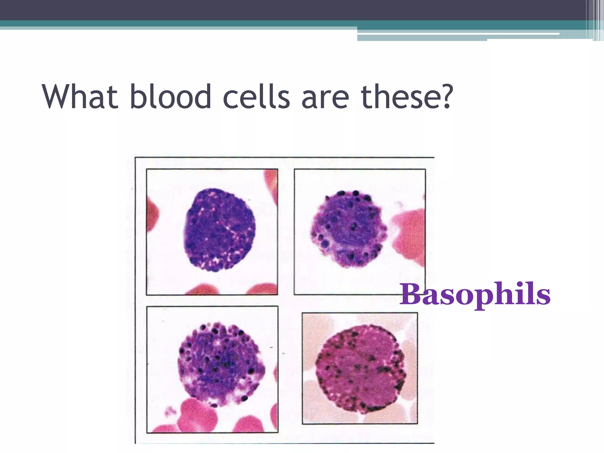 What blood cells are these?Basophils